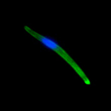 Sporozoite with surface and apical GFP expression