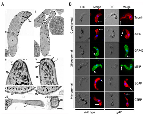 Role of unique plant like phosphatase PPKL in ookinete differentiation. Ookinete shows abnormal apical end in the absence of PPKL